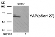 AP55904PU-S - YAP1