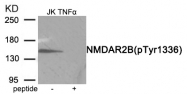 AP55911PU-S - NMDAR2B