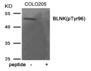 AP55915PU-S - B-cell linker protein / BLNK