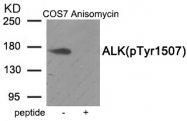 AP55917PU-S - CD246 / Anaplastic lymphoma kinase
