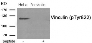 AP55923PU-S - Vinculin (VCL)