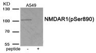 AP55928PU-S - NMDA Receptor 1