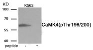 AP55930PU-S - CAMK4