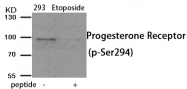 AP55938PU-S - Progesterone receptor