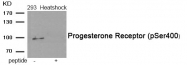 AP55939PU-S - Progesterone receptor