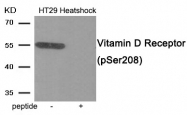 AP55941PU-N - Vitamin D3 receptor / NR1I1