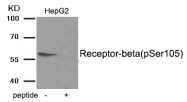 AP55945PU-S - Estrogen receptor beta