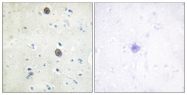 AP55686PU-S - Amyloid beta A4 protein / APP