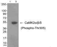 AP55687PU-S - CAMK2A/B/D