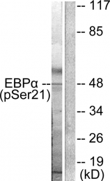 AP55691PU-S - CEBPA