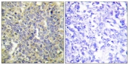 AP55692PU-S - Caspase-9