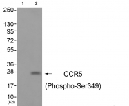 AP55693PU-S - CD195 / CCR5
