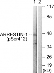 AP55695PU-S - Arrestin beta-1 / ARRB1