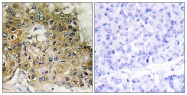 AP55700PU-N - CD29 / Integrin beta-1
