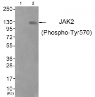 AP55701PU-S - Tyrosine-protein kinase JAK2