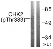 AP55715PU-N - CHK2