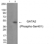 AP55722PU-S - GATA2