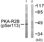 AP55723PU-S - PRKAR2B