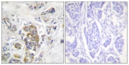 AP55727PU-S - CD104 / Integrin beta-4