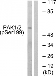AP55728PU-S - PAK1