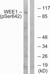 AP55734PU-S - WEE1 / Wee1-like protein kinase