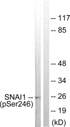AP55737PU-S - SNAI1