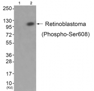 AP55744PU-S - Retinoblastoma-associated protein / RB1