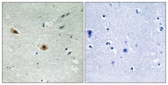 AP55744PU-S - Retinoblastoma-associated protein / RB1