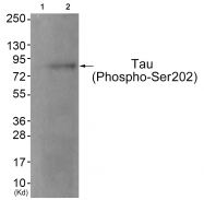 AP55747PU-S - MAPT / TAU