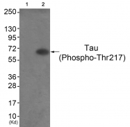 AP55748PU-S - MAPT / TAU