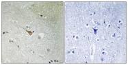 AP55750PU-S - CD246 / Anaplastic lymphoma kinase