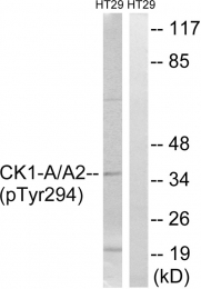 AP55752PU-S - CSNK1A1