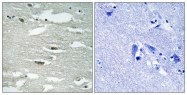 AP55757PU-S - Integrin-linked protein kinase
