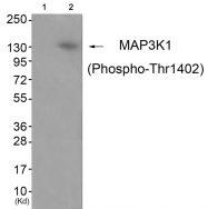 AP55761PU-S - MAP3K1