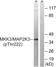 AP55763PU-S - MAP2K3