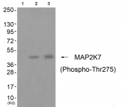 AP55765PU-S - MAP2K7