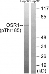 AP55768PU-S - OXSR1 / OSR1