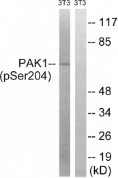 AP55769PU-S - PAK1