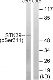 AP55774PU-S - STK39 / SPAK