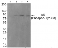 AP55780PU-S - Androgen receptor