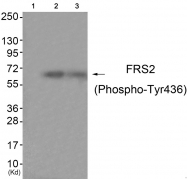 AP55788PU-S - FRS2