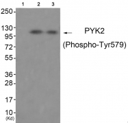AP55794PU-S - FAK2 / PTK2B