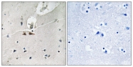 AP55798PU-S - Ephrin-B1/B2/B3