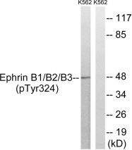 AP55798PU-S - Ephrin-B1/B2/B3