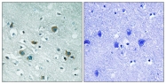 AP55813PU-N - DPYSL2 / CRMP2