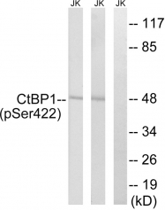 AP55814PU-S - CTBP1