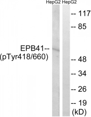 AP55817PU-S - EPB41 / Protein 4.1