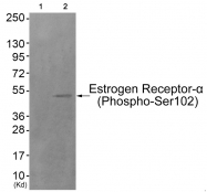 AP55819PU-N - Estrogen receptor alpha