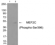 AP55825PU-S - MEF2C