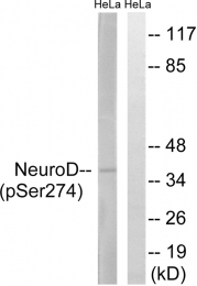 AP55826PU-S - NEUROD1
